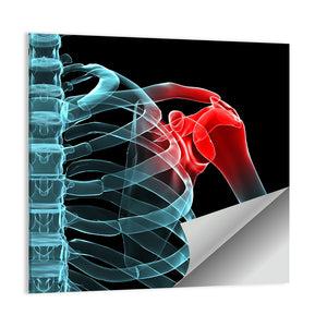 Painful Shoulder X Ray Wall Art