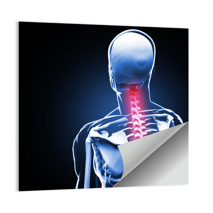 Spine Pain Anatomy Illustration Wall Art