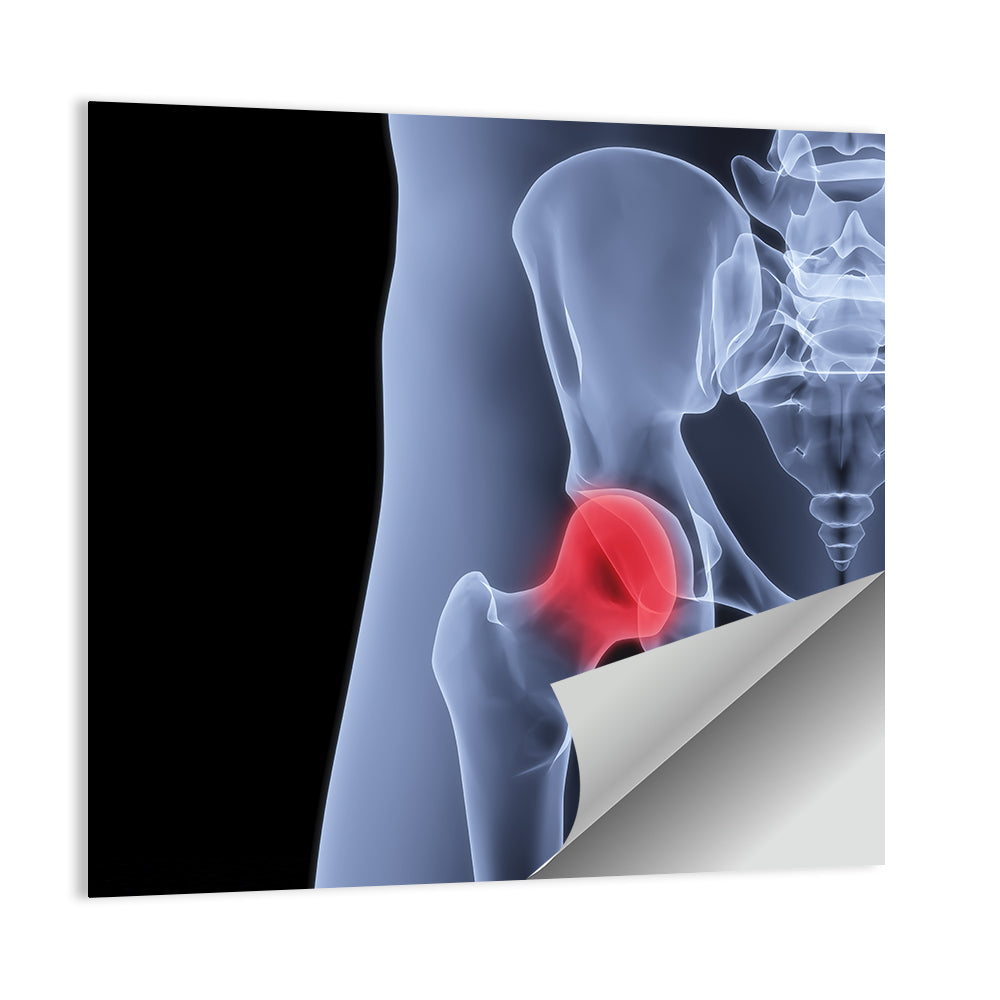 Lateral Hip Joint X-ray Wall Art