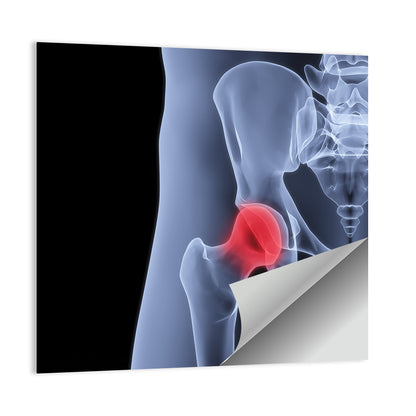 Lateral Hip Joint X-ray Wall Art