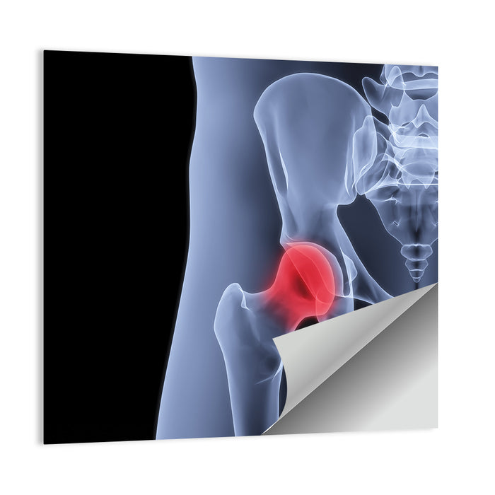 Lateral Hip Joint X-ray Wall Art as a poster print