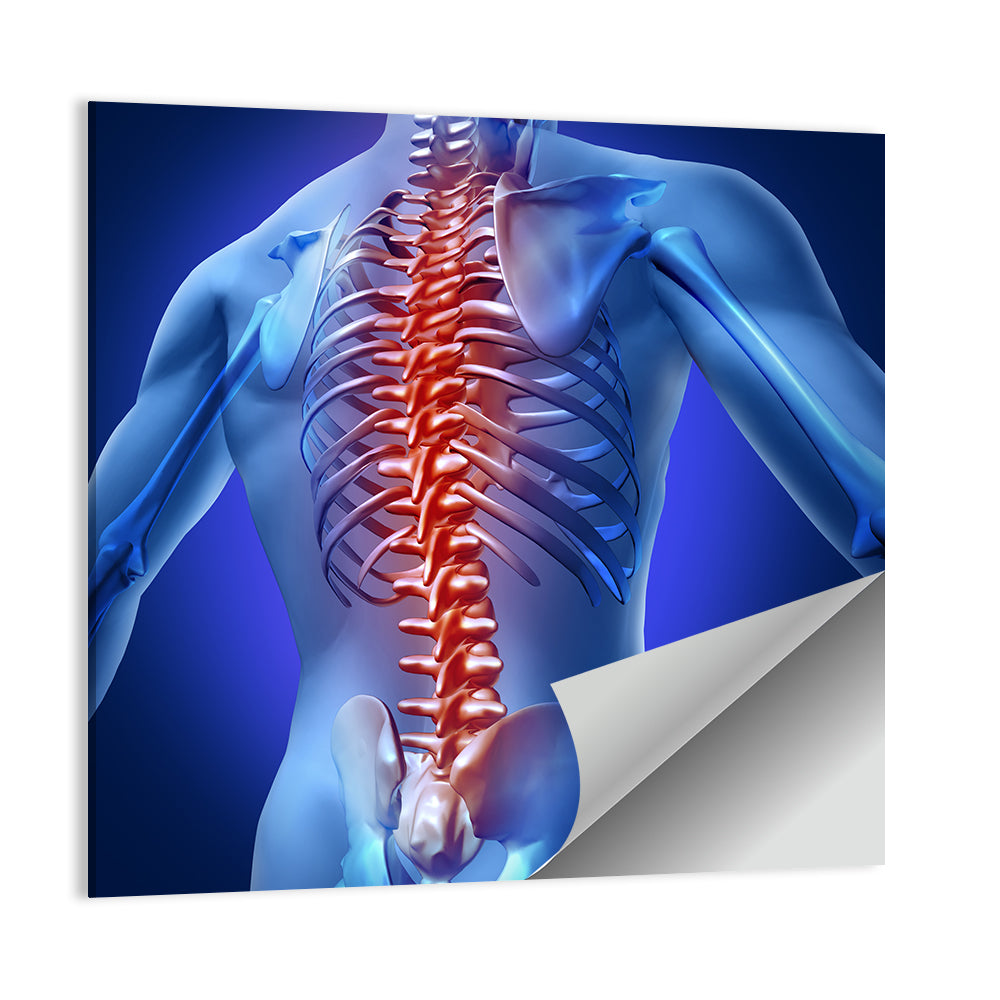 Spine Pain Anatomy Illustration Wall Art