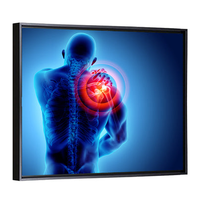 Shoulder Pain X-ray Wall Art