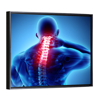 Cervical Spine X-ray Illustration Wall Art