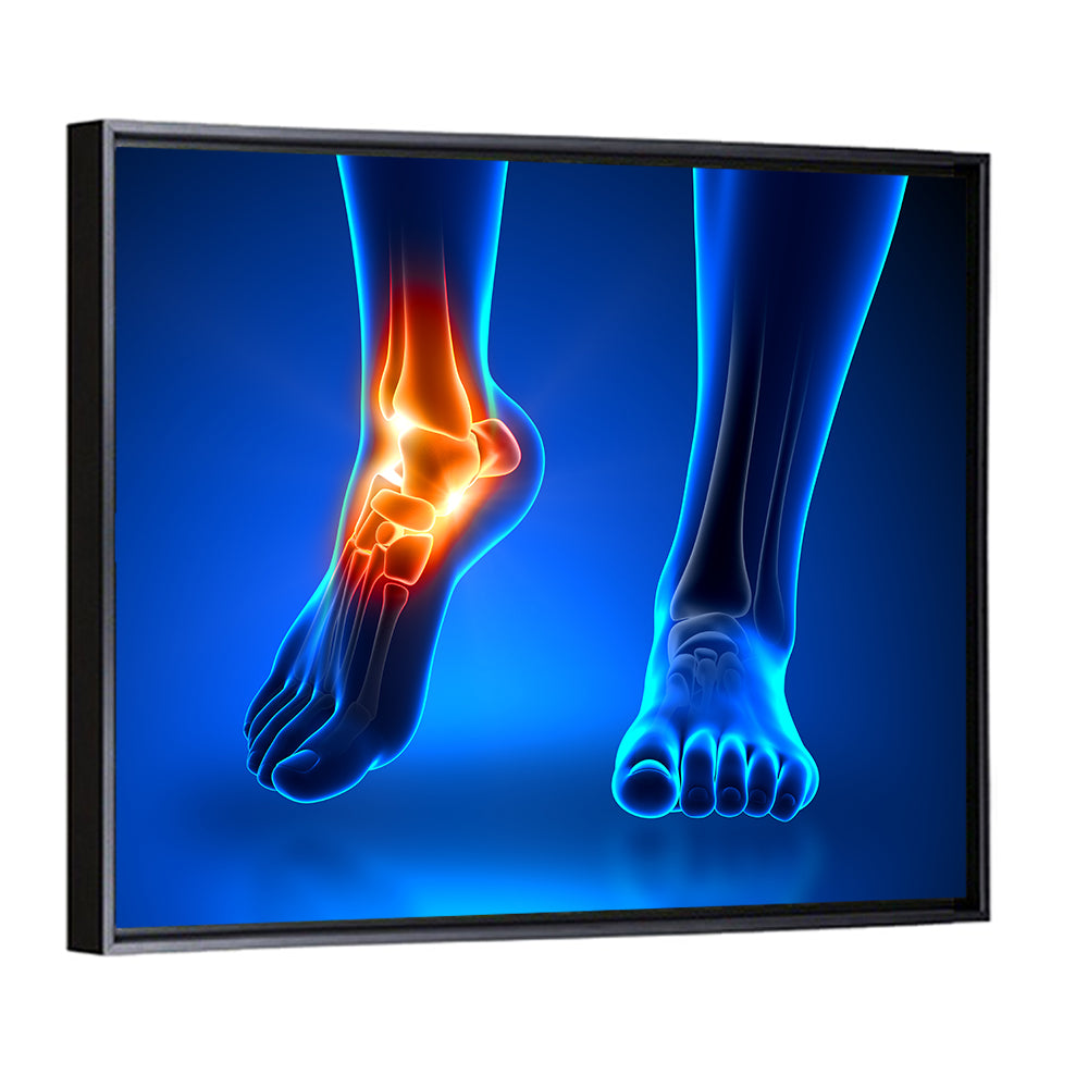 Ankle Anatomy X-ray Study Wall Art