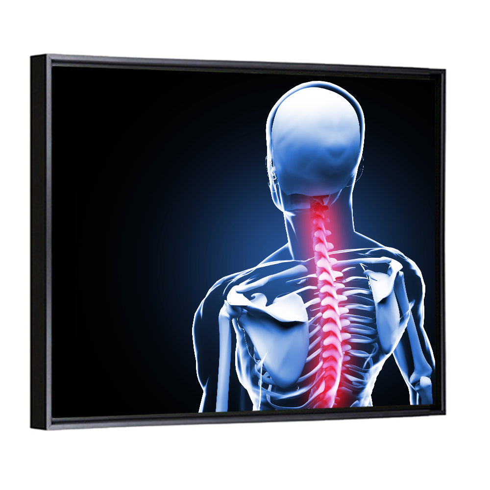Spine Pain Anatomy Illustration Wall Art
