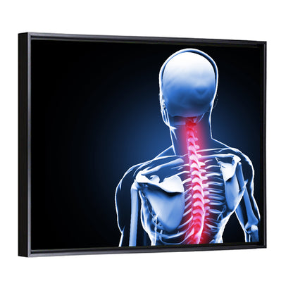 Spine Pain Anatomy Illustration Wall Art