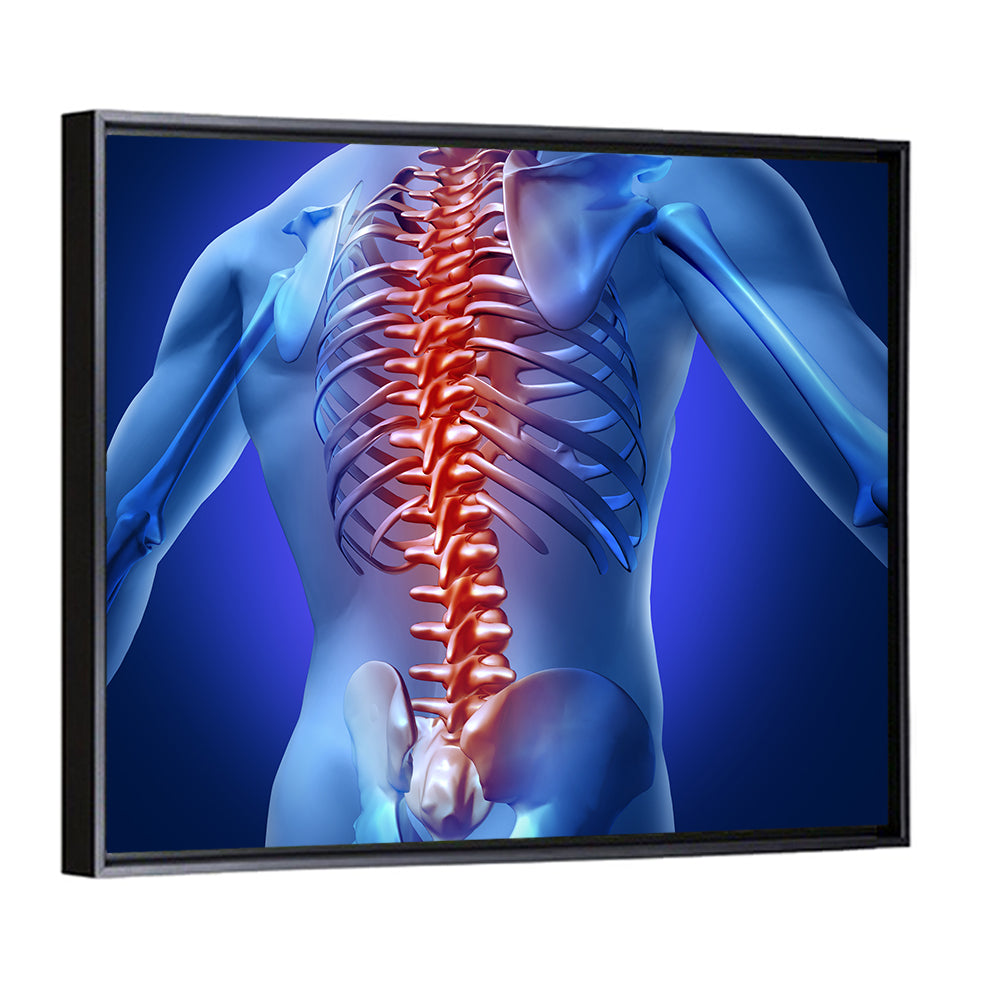 Spine Pain Anatomy Illustration Wall Art