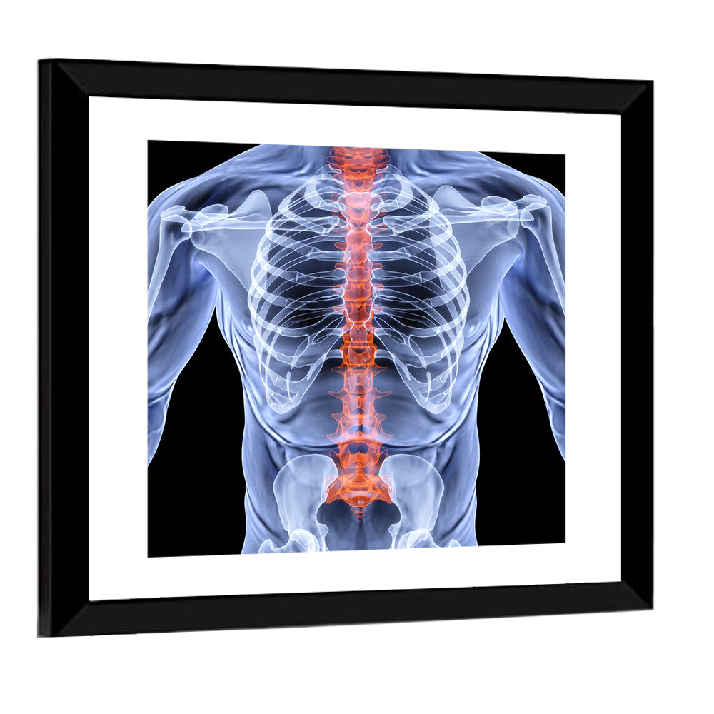 Male Spine X-ray Illustration Wall Art