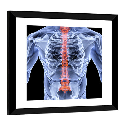 Male Spine X-ray Illustration Wall Art
