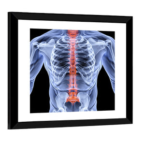 Men Backbone X-Ray Wall Art