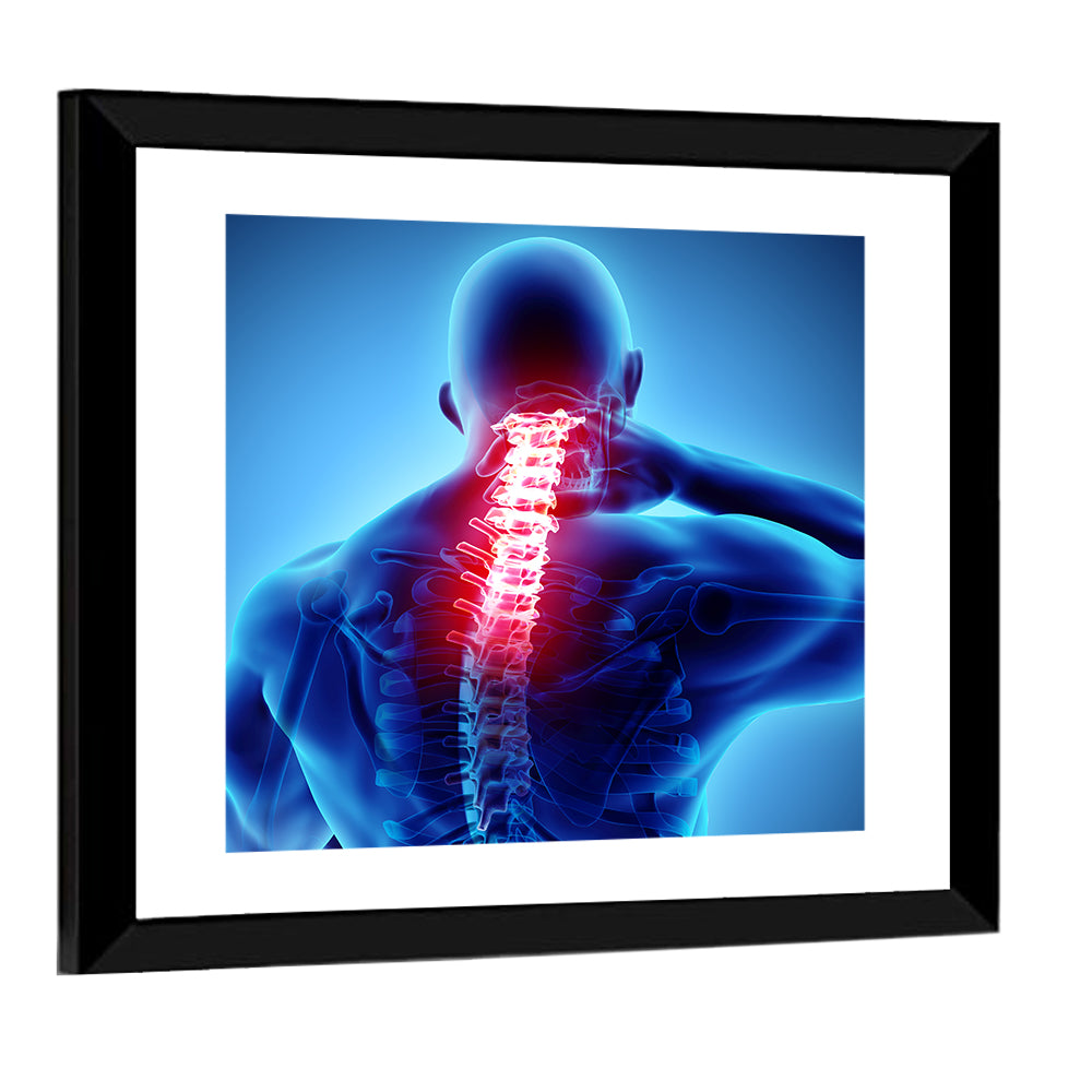 Cervical Spine X-ray Illustration Wall Art