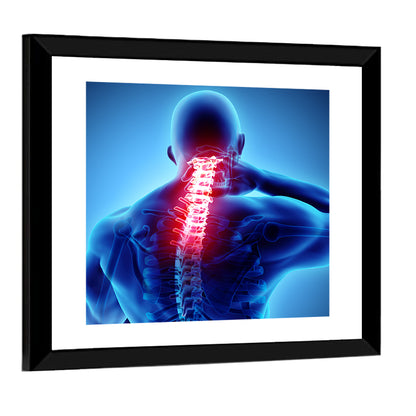 Cervical Spine X-ray Illustration Wall Art