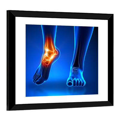 Ankle Pain Anatomy Wall Art