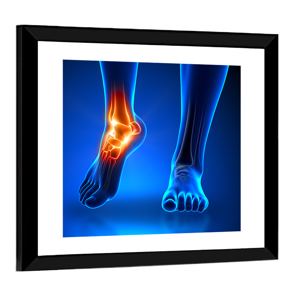 Ankle Anatomy X-ray Study Wall Art
