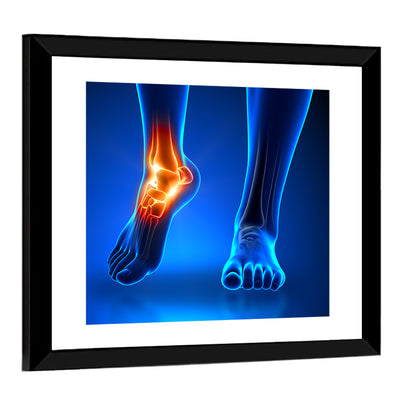 Ankle Anatomy X-ray Study Wall Art