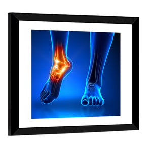 Ankle Pain Wall Art