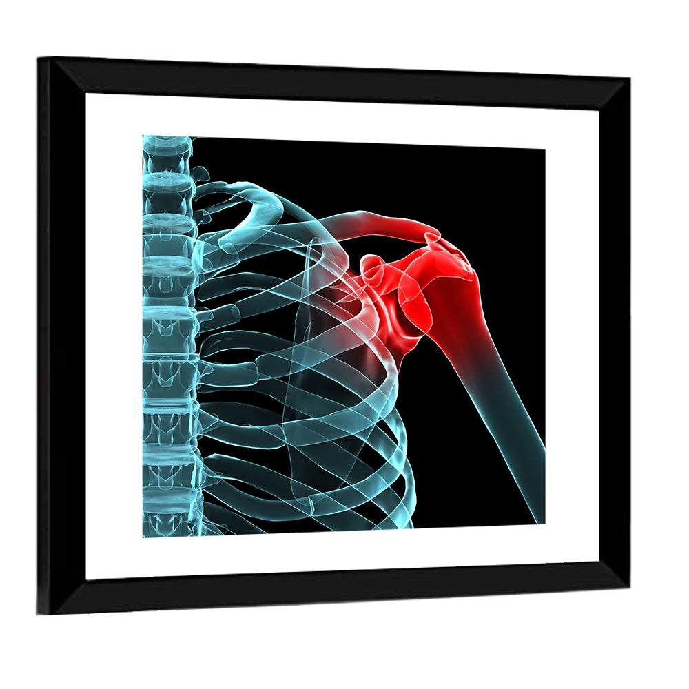Lateral Shoulder X-ray Wall Art