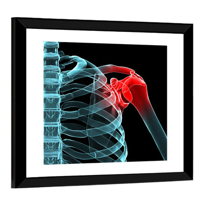Lateral Shoulder X-ray Wall Art