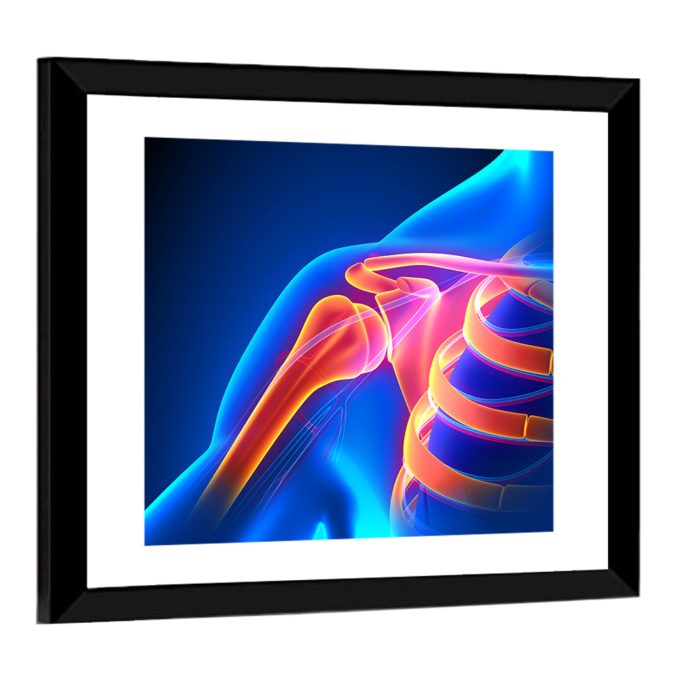 Shoulder Pain Anatomy Study Wall Art
