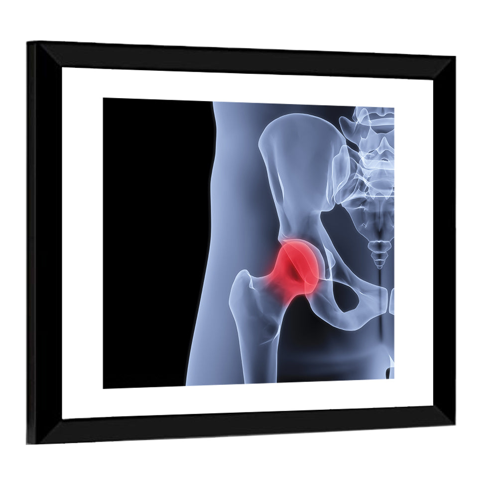 Lateral Hip Joint X-ray Wall Art