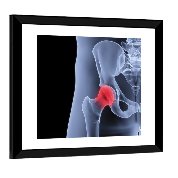 Lateral Hip Joint X-ray Wall Art as a framed print