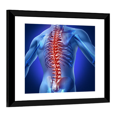 Spine Pain Anatomy Illustration Wall Art