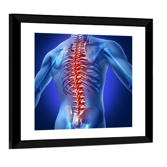 Spine Pain Anatomy Illustration Wall Art