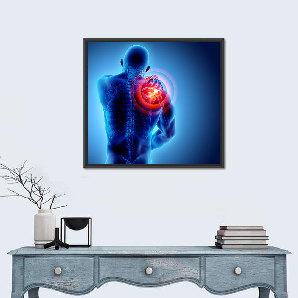 Shoulder Pain X-ray Wall Art