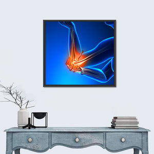 Elbow Pain Wall Art