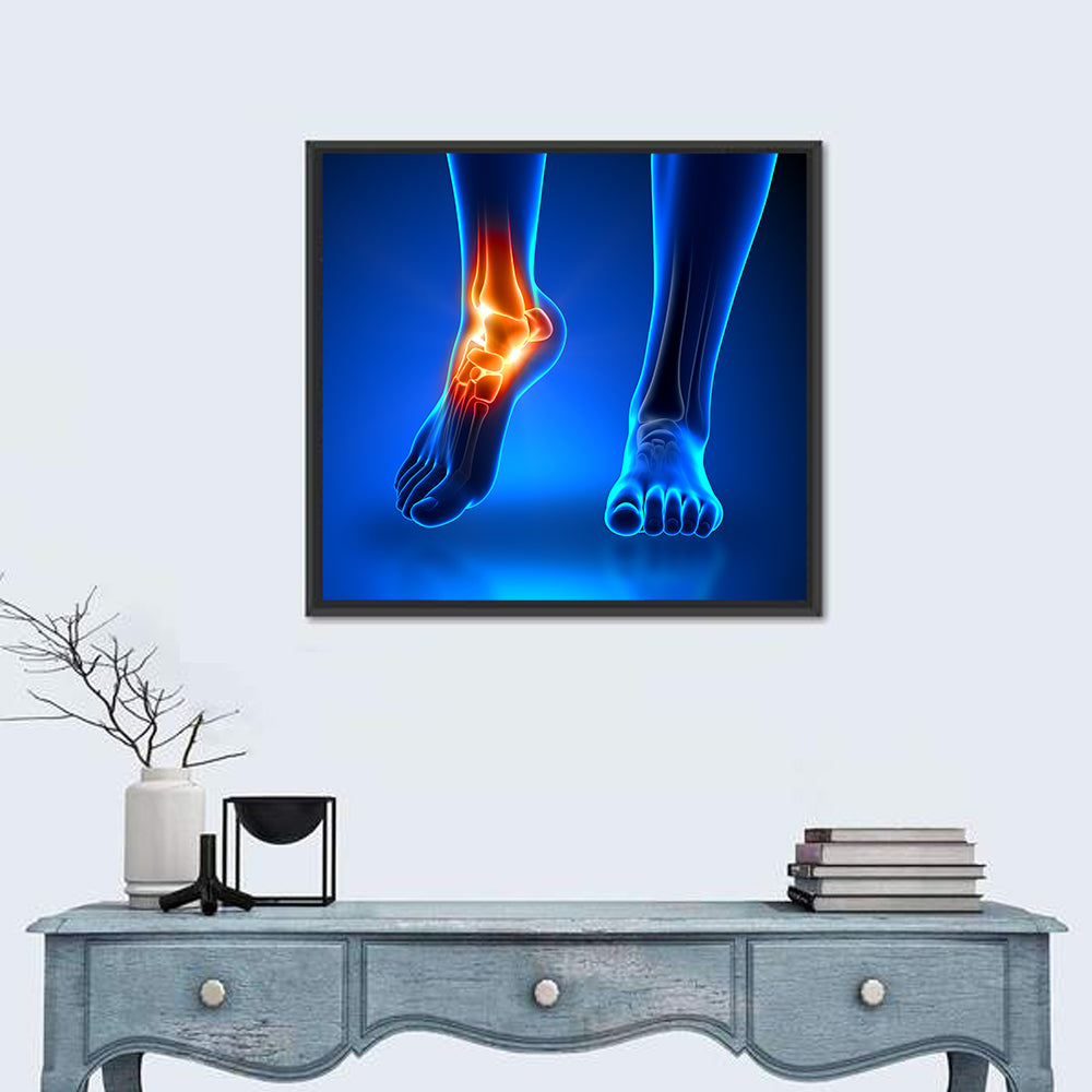 Ankle Anatomy X-ray Study Wall Art