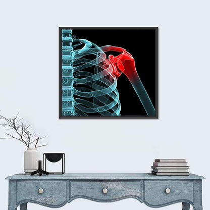 Lateral Shoulder X-ray Wall Art