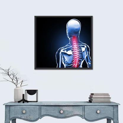 Spine Pain Anatomy Illustration Wall Art