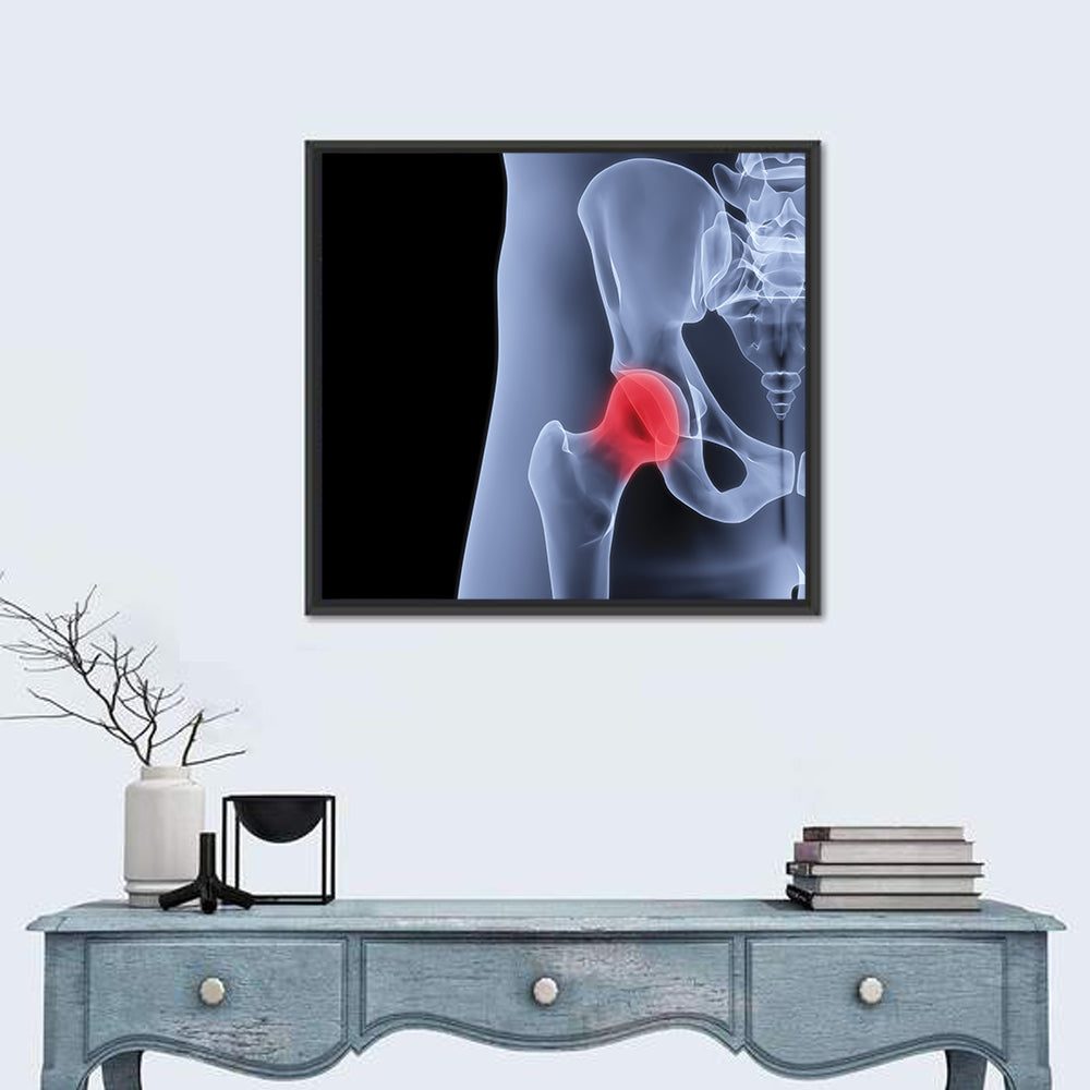 Lateral Hip Joint X-ray Wall Art in a room, square