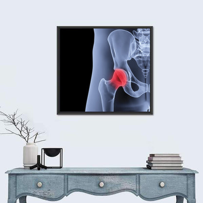Lateral Hip Joint X-ray Wall Art