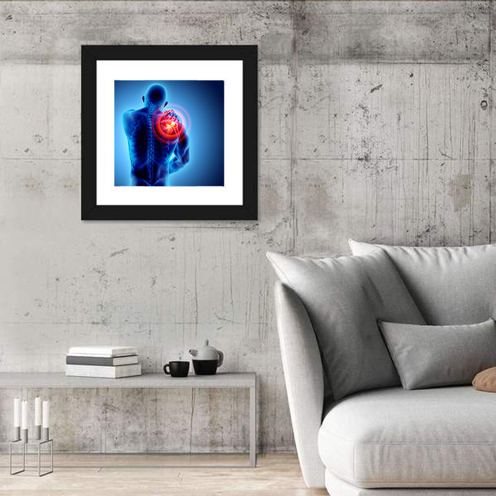 Shoulder Pain X-ray Wall Art
