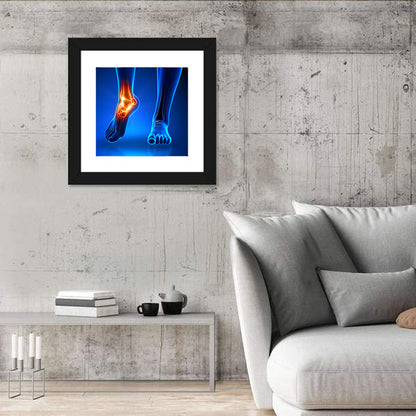 Ankle Anatomy X-ray Study Wall Art