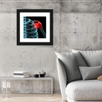 Lateral Shoulder X-ray Wall Art