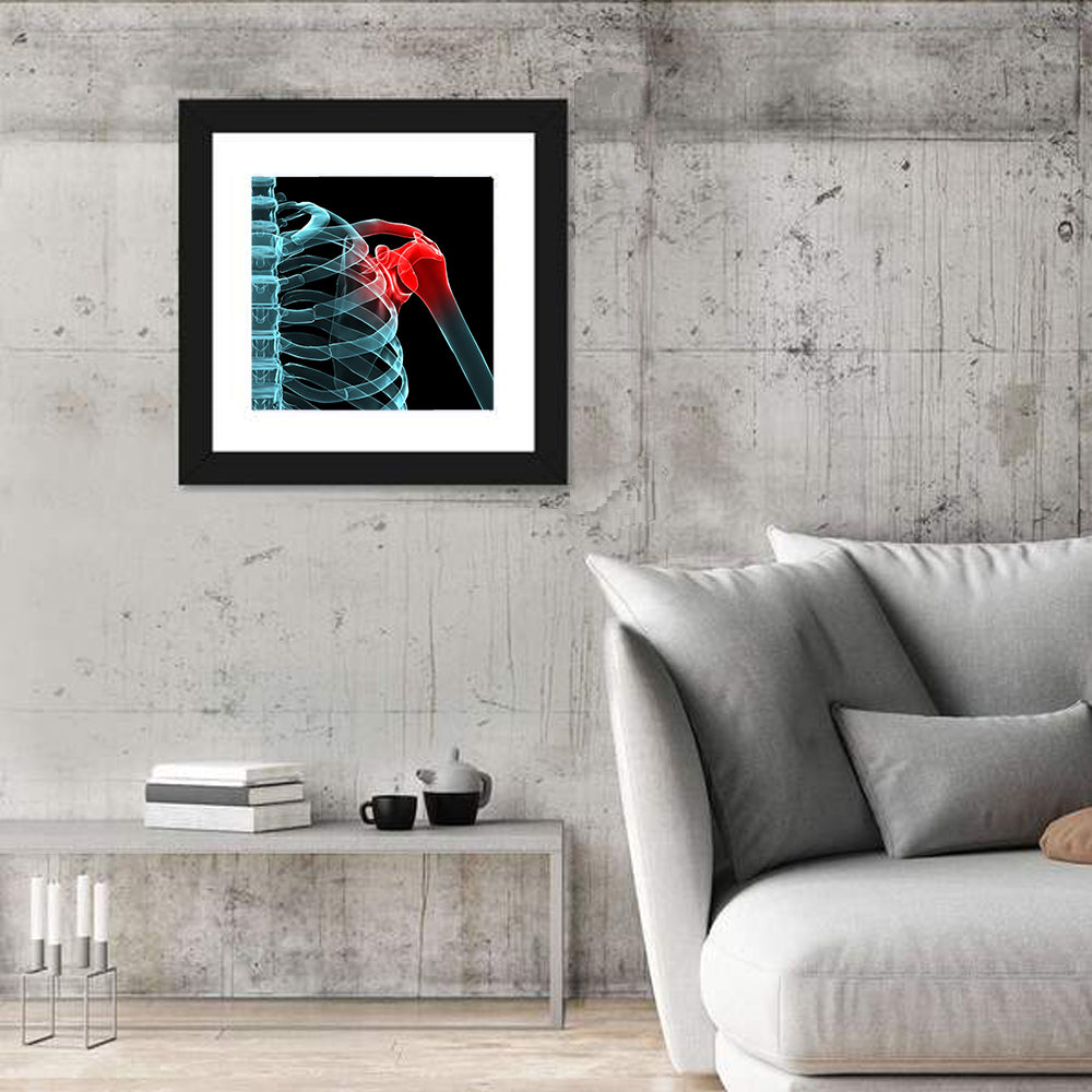 Lateral Shoulder X-ray Wall Art
