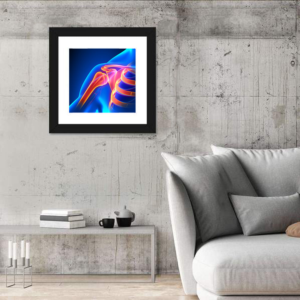 Shoulder Pain Anatomy Study Wall Art