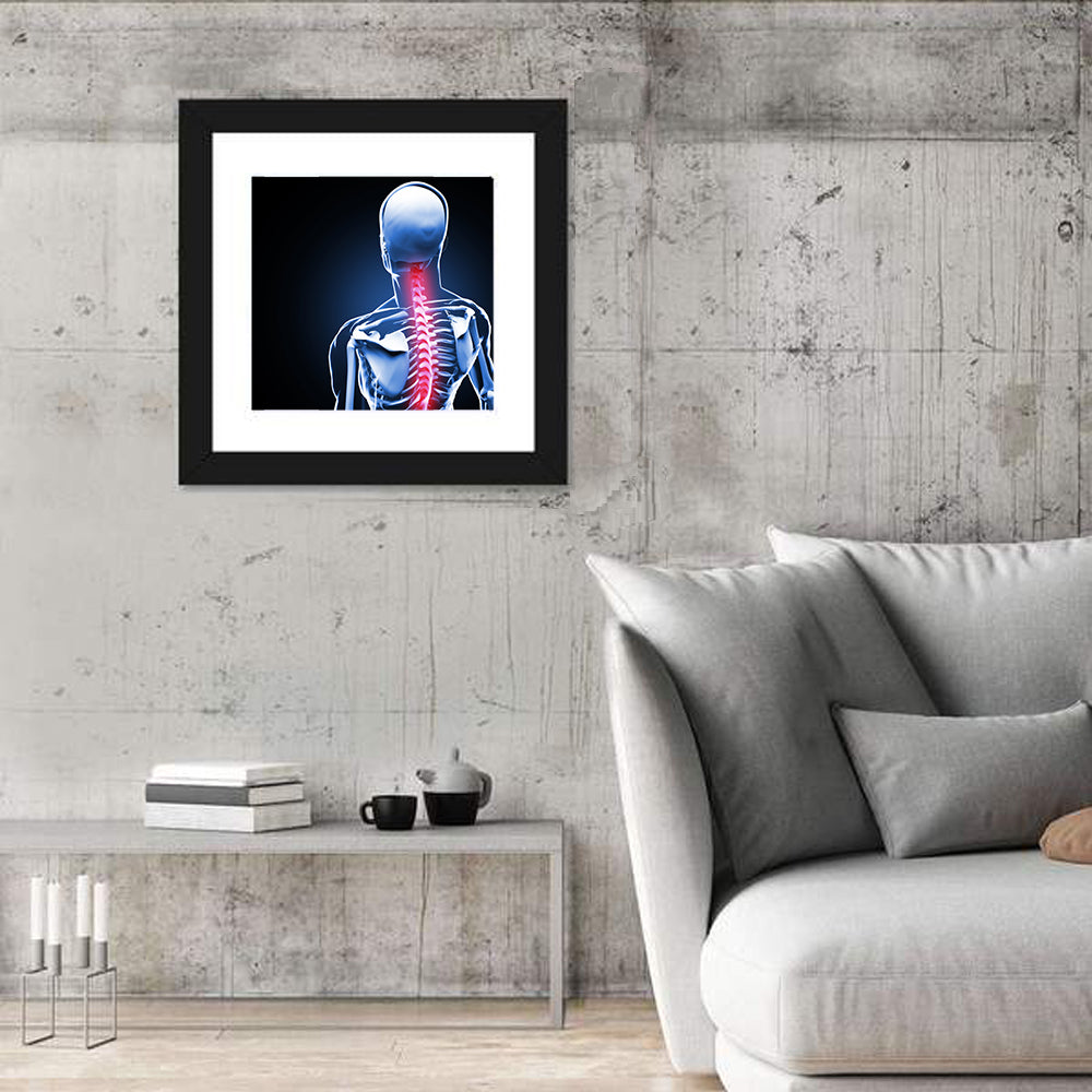 Spine Pain Anatomy Illustration Wall Art