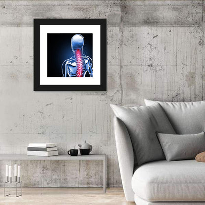 Spine Pain Anatomy Illustration Wall Art