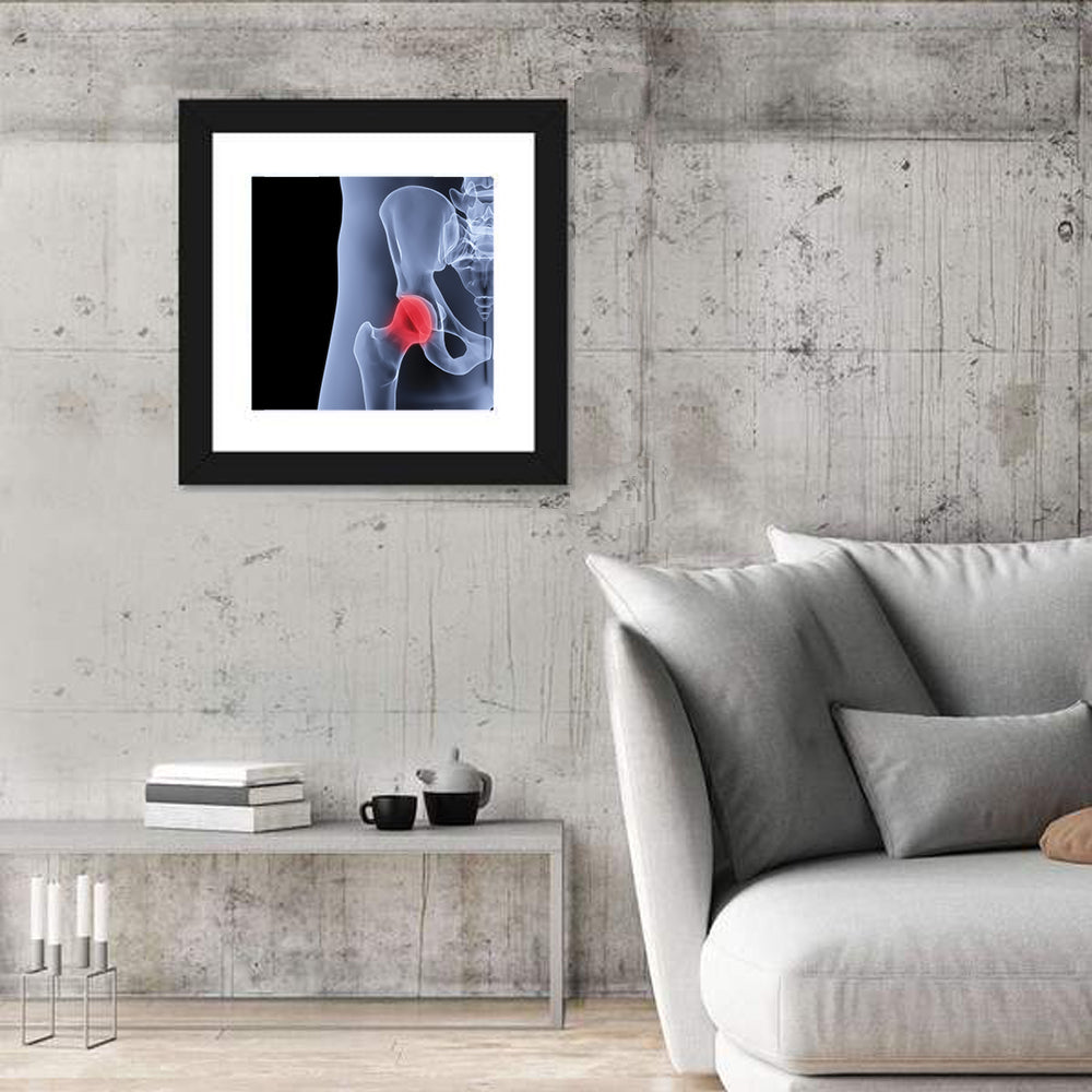 Lateral Hip Joint X-ray Wall Art in a room, square