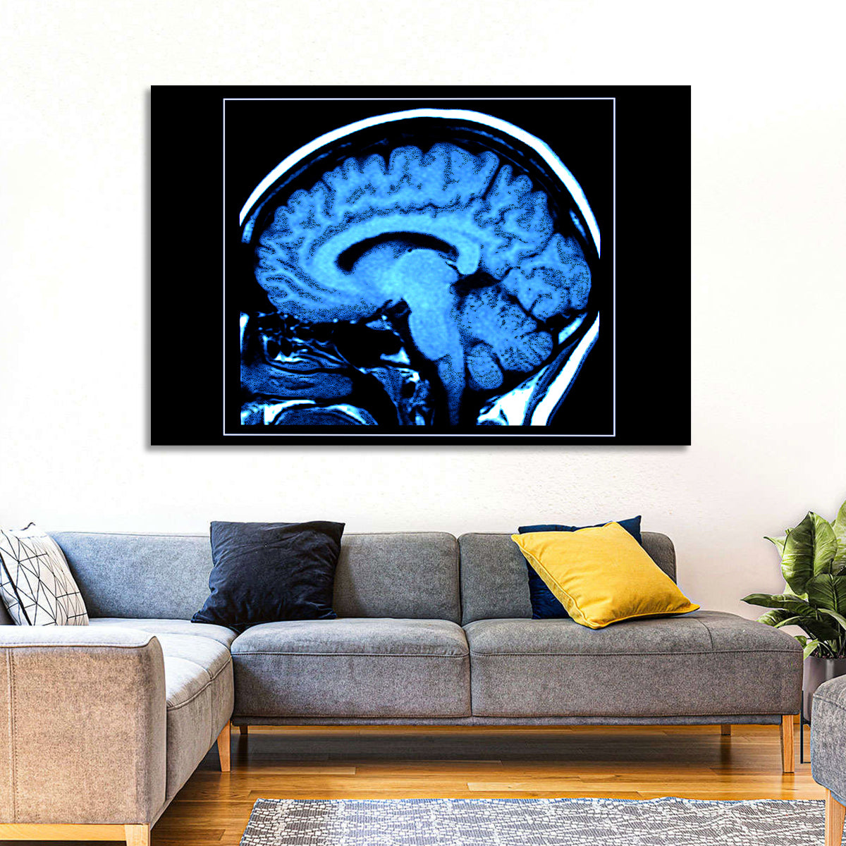 Sagittal Brain Mri Scan in Blue Wall Art in a room, landscape