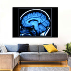 Sagittal Brain Mri Scan in Blue Wall Art