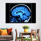 Sagittal Brain Mri Scan in Blue Wall Art