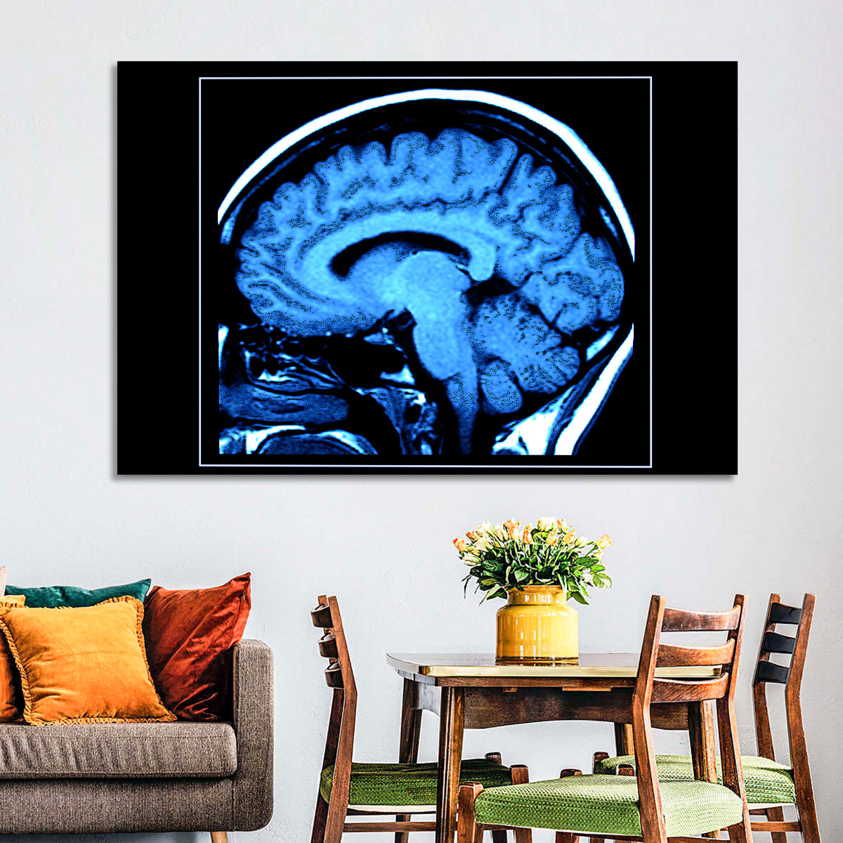 Sagittal Brain Mri Scan in Blue Wall Art