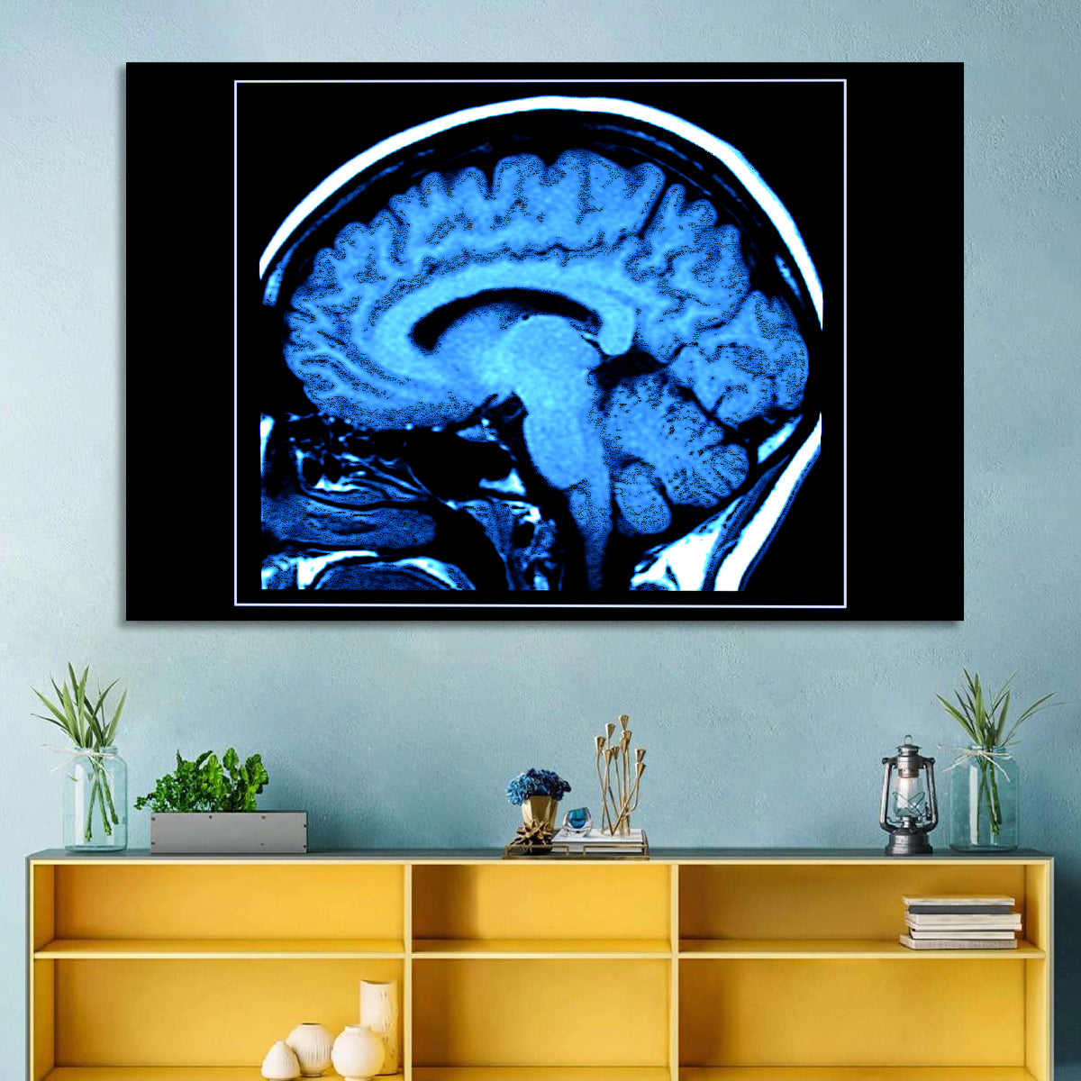Sagittal Brain Mri Scan in Blue Wall Art in a room, landscape