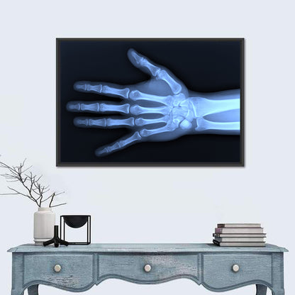 Blue Hand Radiograph Wall Art