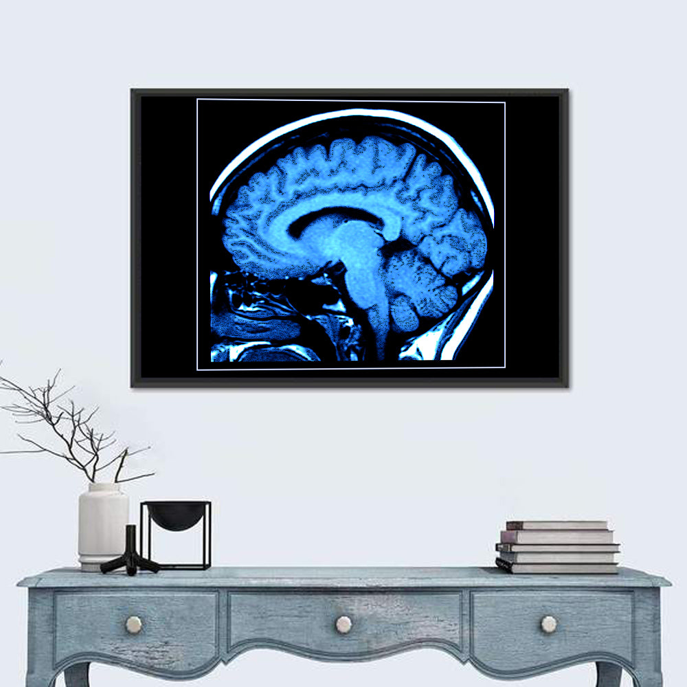 Sagittal Brain Mri Scan in Blue Wall Art in a room, landscape